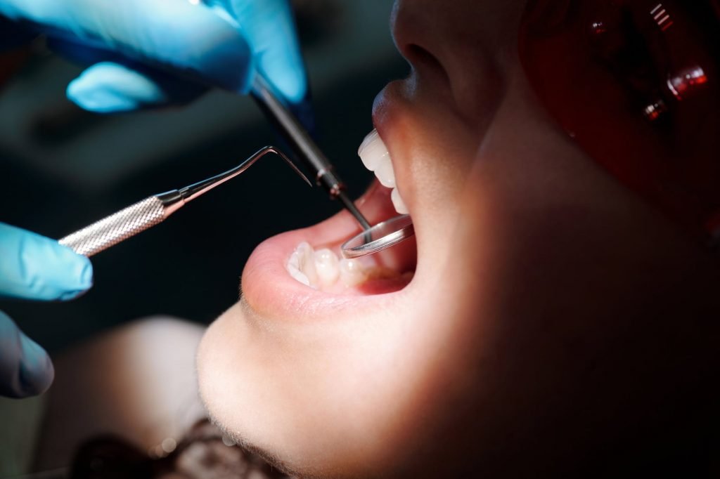 Image of An Open Mouth of a Person