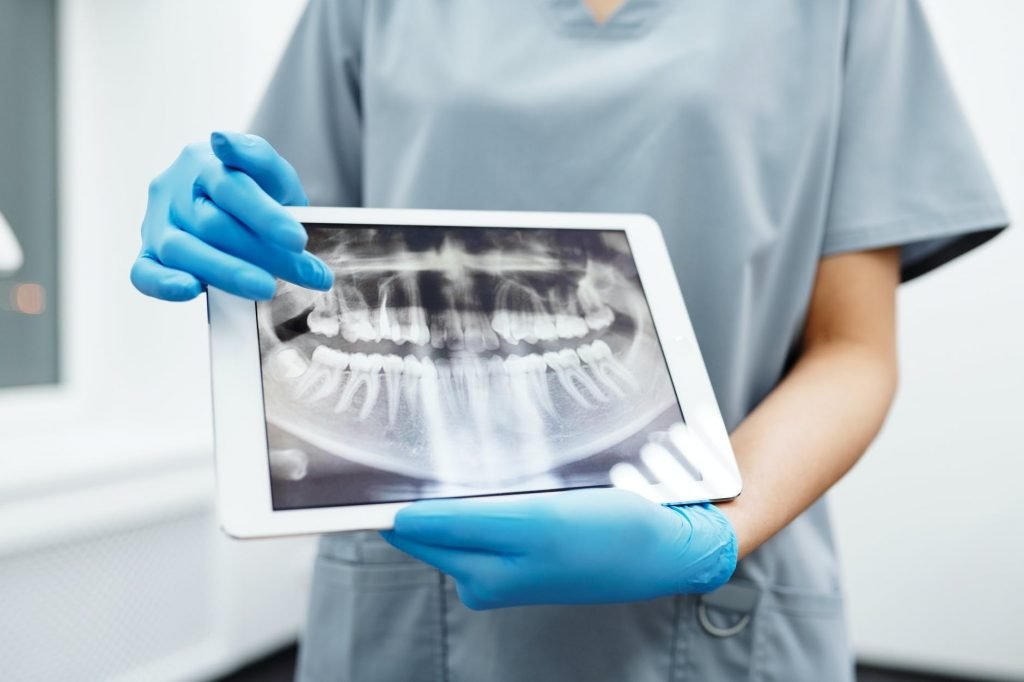 Image of Person Holding White Tablet Computer with Picture of Teeth